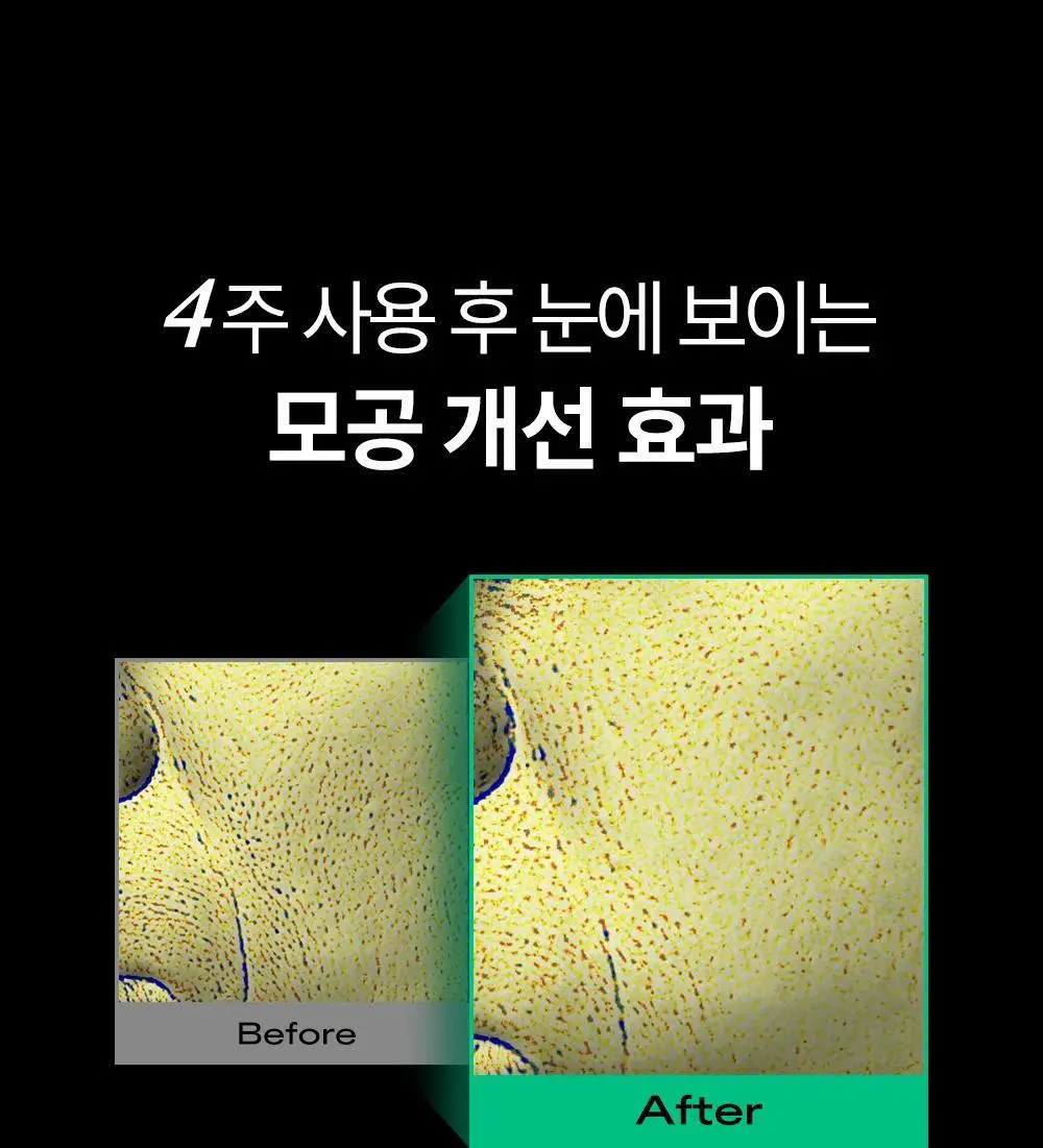 [모공피지순삭/수분진정] 듀이트리 AC 딥 맨즈 카밍 포어 올인원 200ml 기획 (+20ml) 상세페이지 20